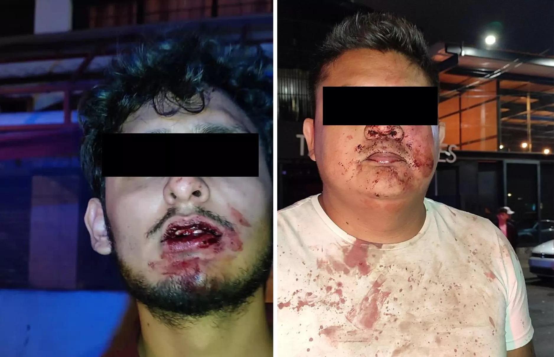 Personal de bar en la Avenida Juárez golpeó a seis clientes 