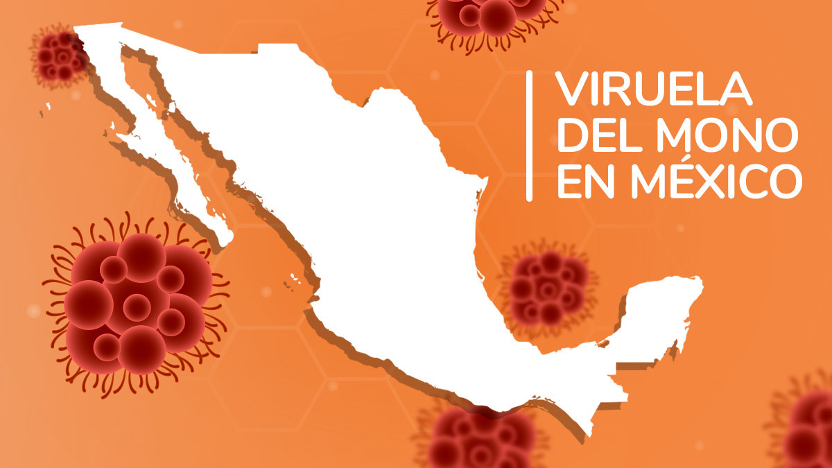 Éstos son los estados de México que presentan casos de viruela del mono; revisa si hay en tu entidad
