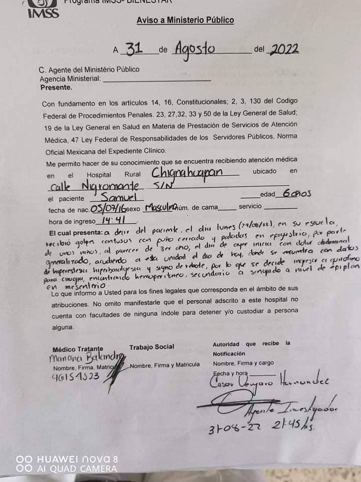 Golpean severamente a menor en primaria de Chignahuapan