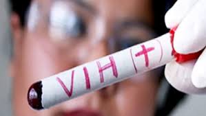 Cuatro mil 667 personas en Puebla viven con VIH y son atendidas con tratamiento antirretroviral: Salud