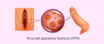 El VPH y su relación con el cáncer
