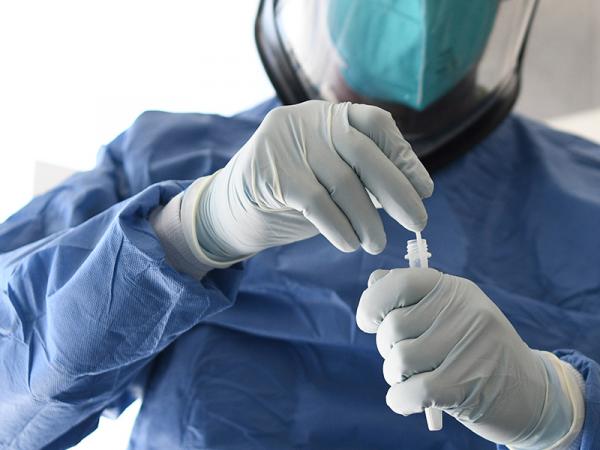 Mantiene Puebla tendencia a la baja en contagios de COVID-19: Salud