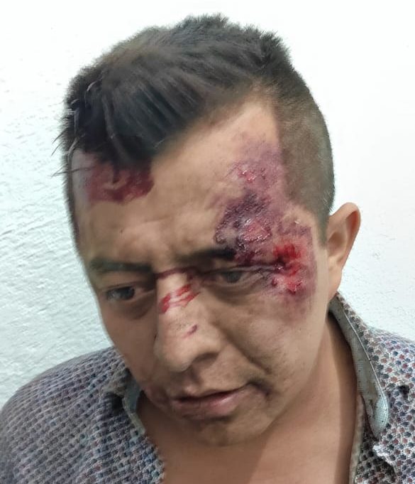 Detienen al alcalde de Tepeyahualco por disparar contra unas gradas en la Feria de Libres