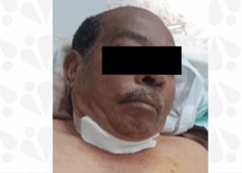 Confirman sentencia de 47 años de prisión por feminicidio en Hueytamalco, Puebla